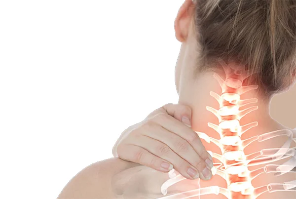 Cervical Spondylitis